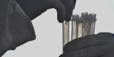 Corona-Schnelltests f&uuml;r zuhause? So sicher sind sie wirklich | Nachfrage gerade vor Weihnachten gro&szlig;