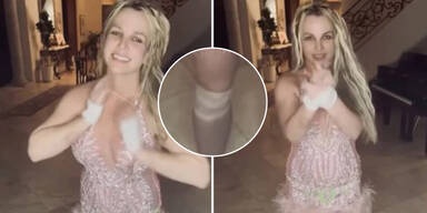 Verband und blaue Flecken: Sorge um Britney Spears (43) immer größer