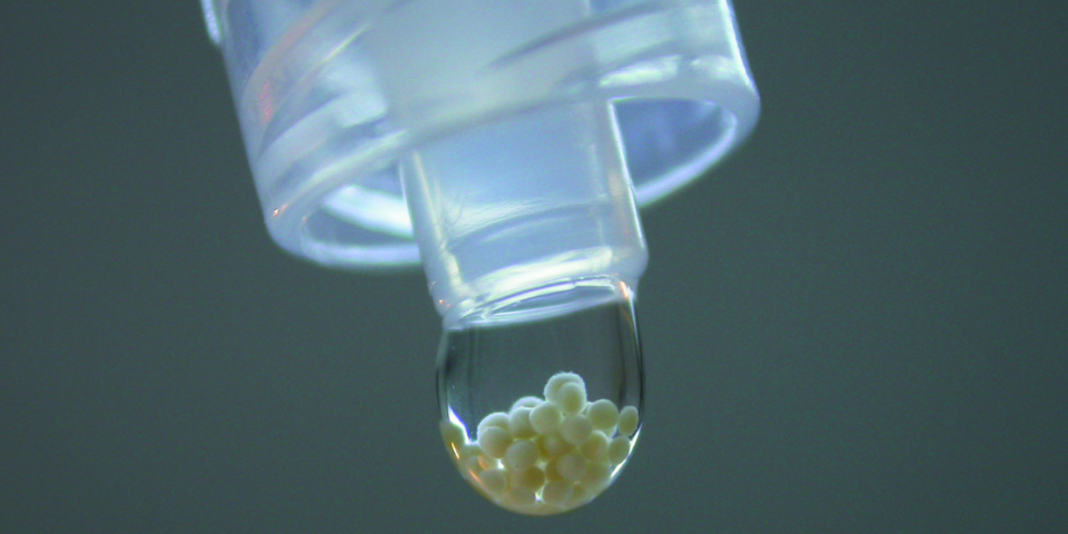 Sphäroide – kleine Perlen aus körpereigenen Knorpelzellen 