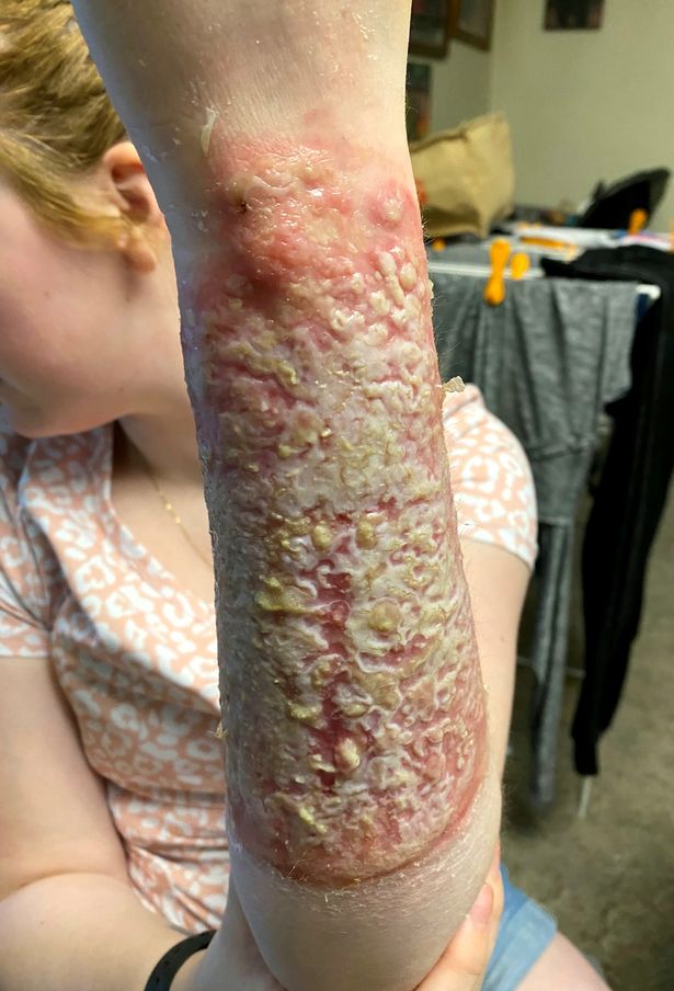 Courtesy Jenna Allen / SWNS