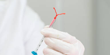 Defekte Spirale: 600 Frauen klagen die Republik