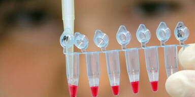 Stammzellenforschung