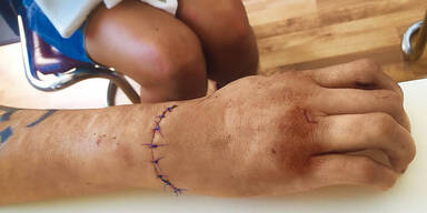 Blutbad in Asylwerber-WG