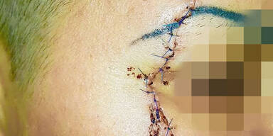 Blutbad in Asylwerber-WG