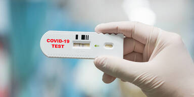 Pfusch-Alarm um 200.000 Tests