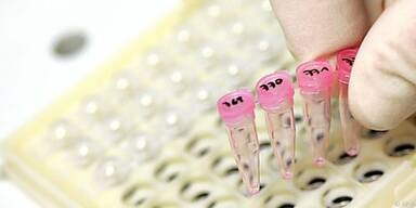 Tests auf HIV und Diabetes