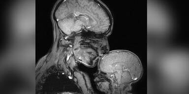 Brains