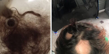 Promishampoo sorgt für Haarausfall