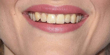 Jaime King - Schlimmer Look, schlimme Z&auml;hne