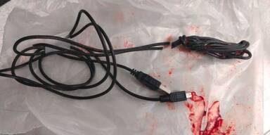 Urology Case Reports