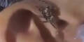 Spinne aus dem Ohr "gespült"