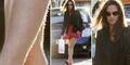 Pippa Middleton mit unrasierten Beinen