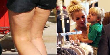 Britney Spears mit Cellulite