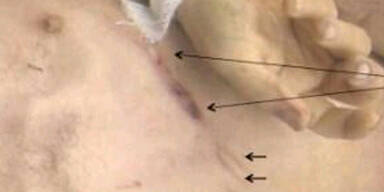 Folterbilder schocken vor Syrien-Konferenz