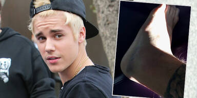 Justin Bieber verletzt