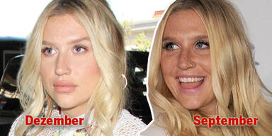 Kesha: Frisch vom Beauty-Doc