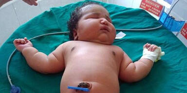 Das ist das schwerste Baby der Welt