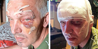 Linz Schl&auml;gerei