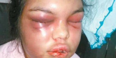 Adolfina Camelli Ortigoza