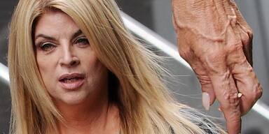 Kirstie Alley: Glattes Gesicht, faltige Hände