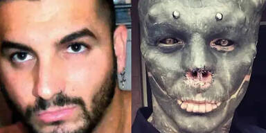 Anthony Loffredo  vor und nach seiner Verwandlung