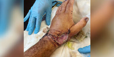 Jackass-Star von Hai attackiert