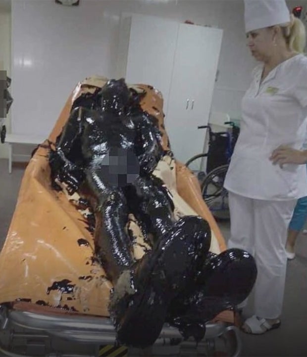 Mann fällt in Teergrube und überlebt wie durch ein Wunder