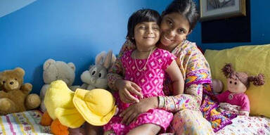 &Auml;rzte operieren M&auml;dchen, dem ein Zwilling aus dem Becken wuchs