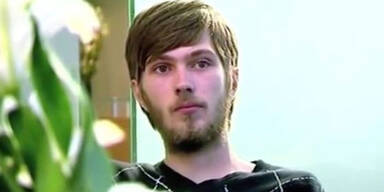 Jay (21) hat noch nie im Leben Z&auml;hne geputzt