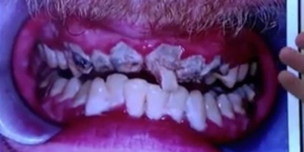 Jay (21) hat noch nie im Leben Zähne geputzt