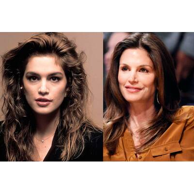 Stars in der Botox-Falle