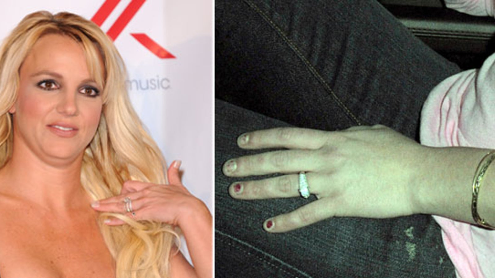 Dumaloq eshak fotosurati