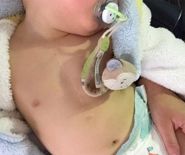 Sarah Lombardi zeigt Alessios OP-Narbe