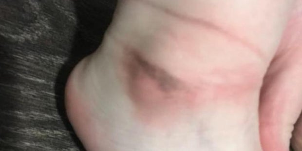 Sandalen festgeklebt