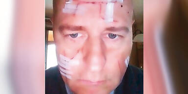 Nazi-Symbol in den Bauch geritzt