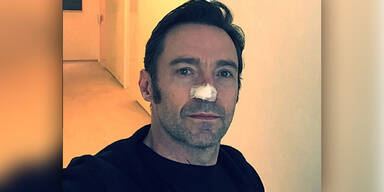 Hugh Jackman