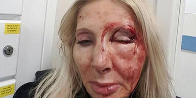 Österreicherin in Londoner U-Bahn brutal verprügelt