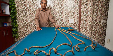 Shridhar Chillal Fingern&auml;gel