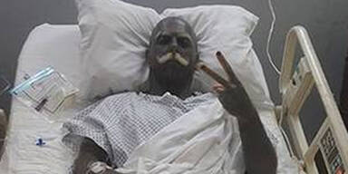 ER lie&szlig; sich Nippel und Genitalien entfernen