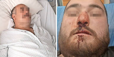 Elektriker verpr&uuml;gelt