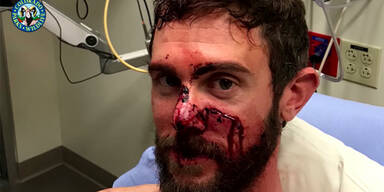 Jogger t&ouml;tet Puma mit blo&szlig;en H&auml;nden: War alles ganz anders?