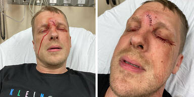 Oliver Pocher Unfall