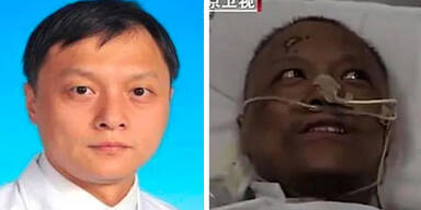 Haut dunkler Coronavirus China Hu Weifeng Yi Fan