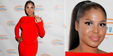 Toni Braxton wegen Lupus im Spital