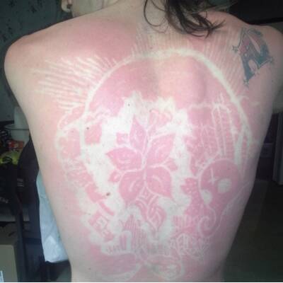 Sonnenbrand-Tattoo