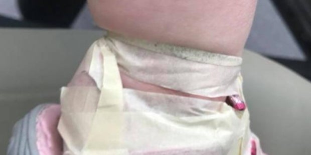 Sandalen festgeklebt