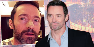 Hugh Jackman