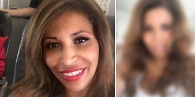 Patricia Blanco: Neue Nase