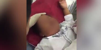 Penis bei Routine-OP in 2 H&auml;lften geschnitten