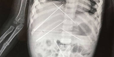 M&auml;dchen (3) als Voodoo-Puppe missbraucht &ndash; tot